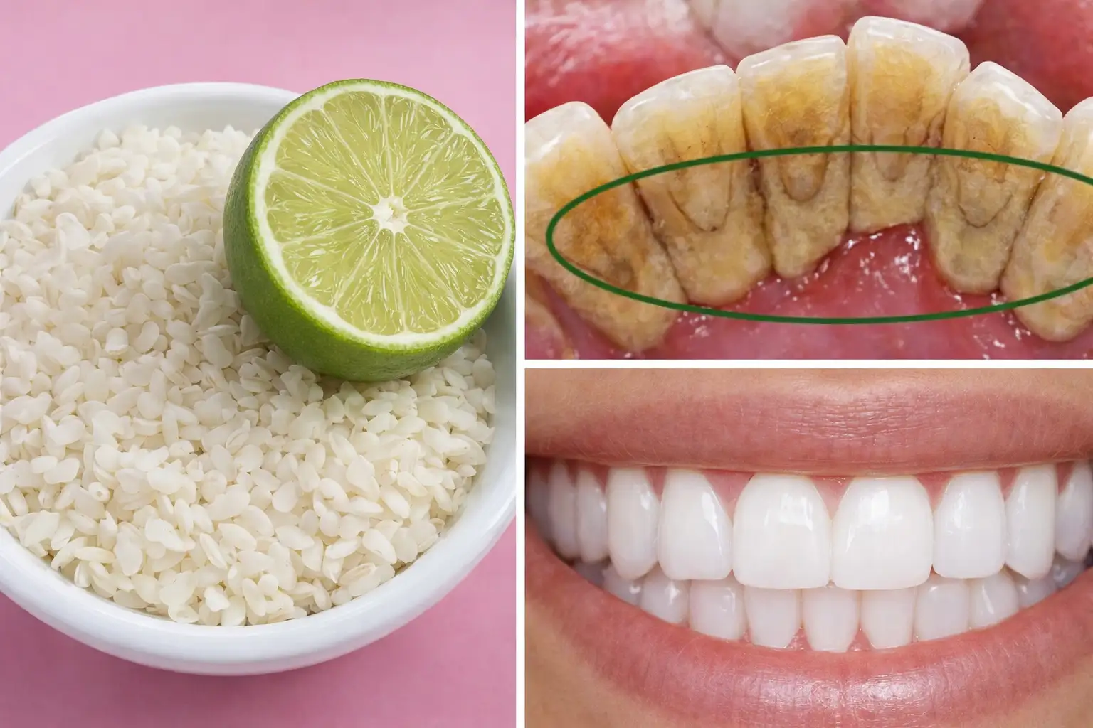 blanquear dientes casa bicarbonato — limón, dientes manchados y dientes blancos